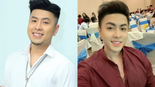 Akira Phan trước và sau khi phẫu thuật thẩm mỹ