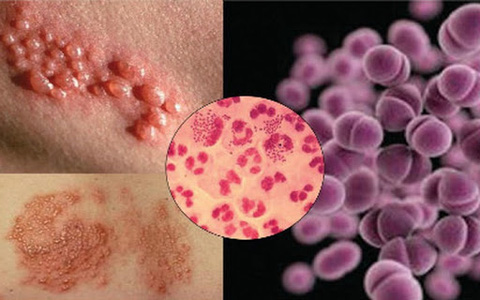 Virus Lậu Virus Lậu